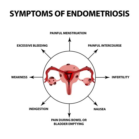 how to reduce inflammation from endometriosis